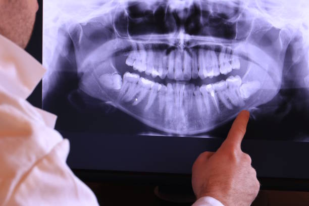 Best Emergency Dental Care for Broken or Chipped Teeth in New London, OH