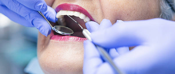 Best Same-Day Emergency Dental Services in New London, OH